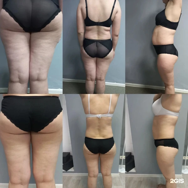 &