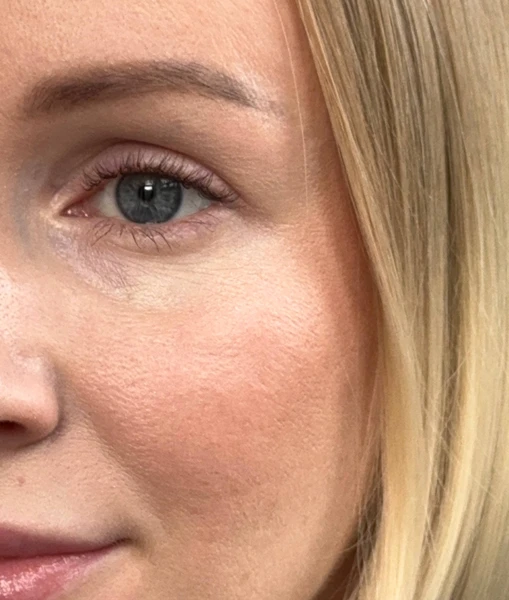 &