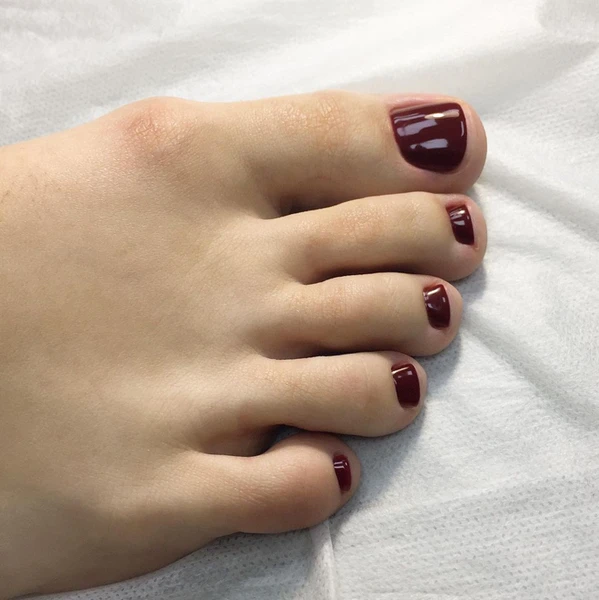 &