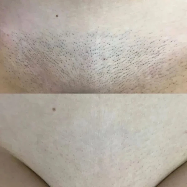 &