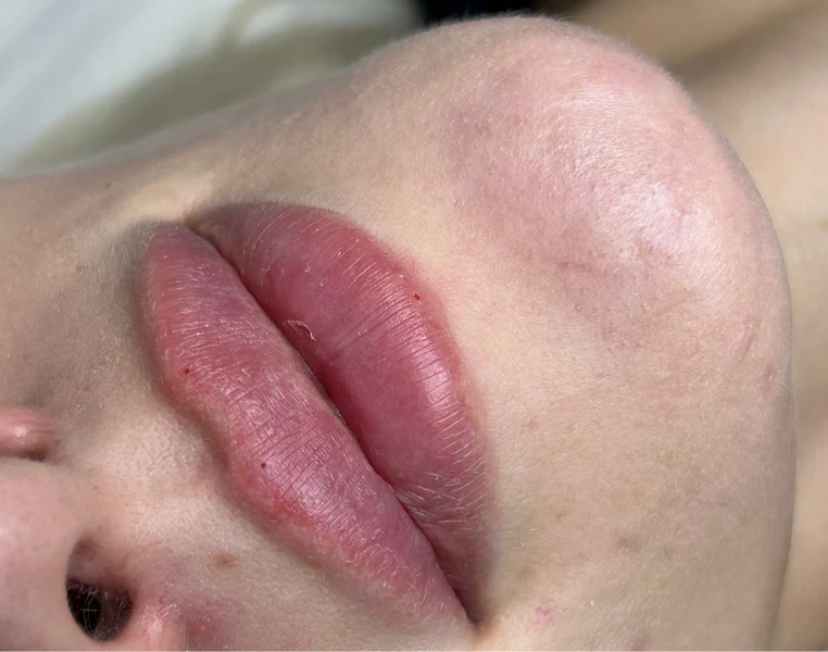 &