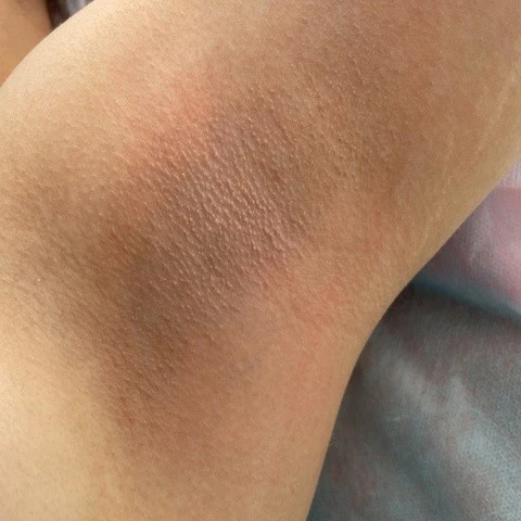 &