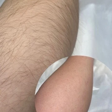 &