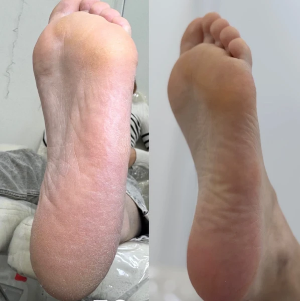 &