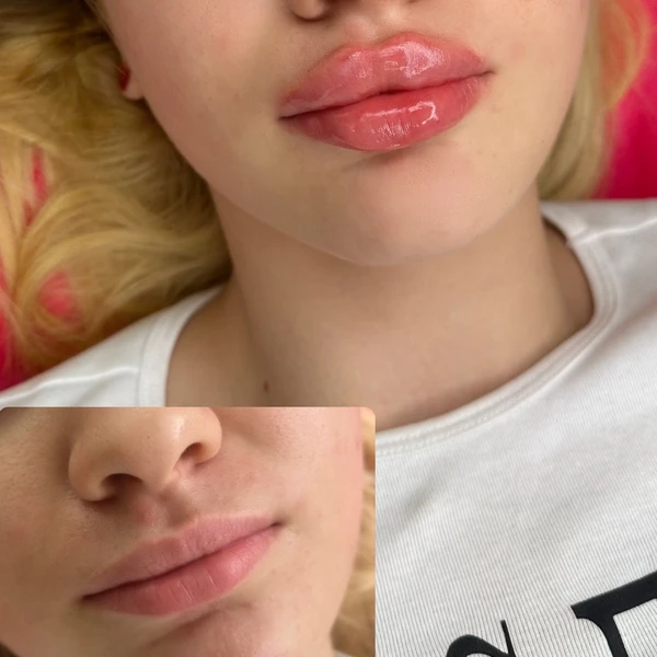 &