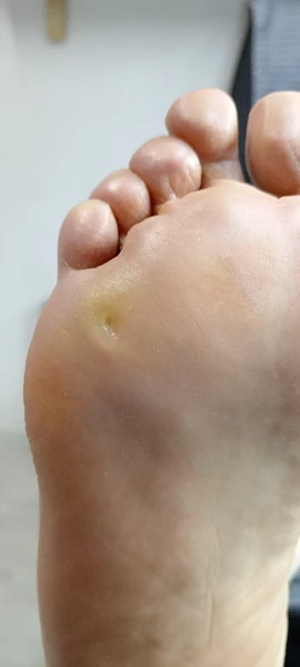 &