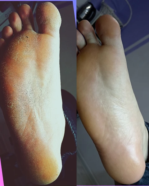 &