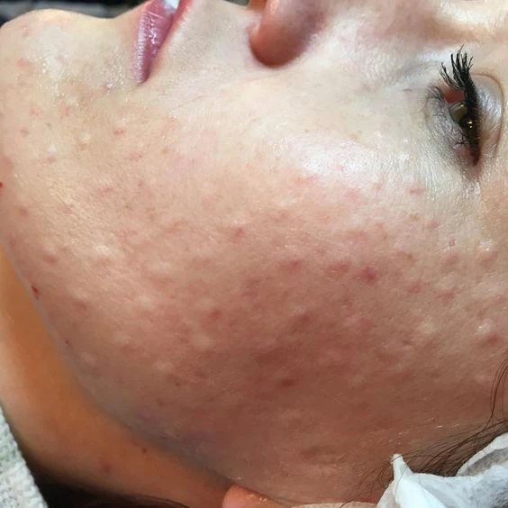 &