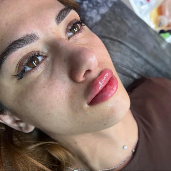 &
