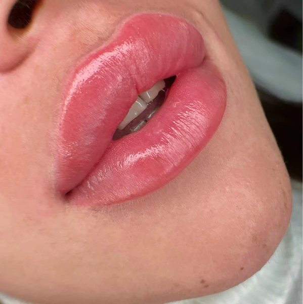 &