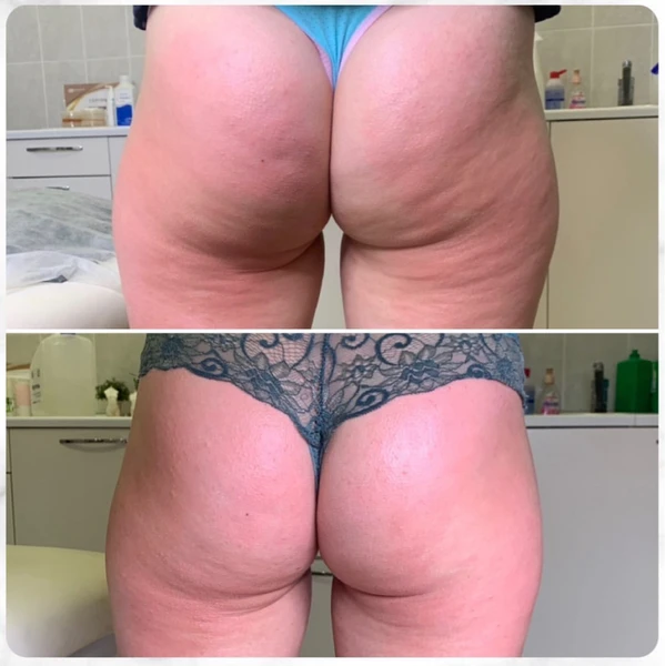 &