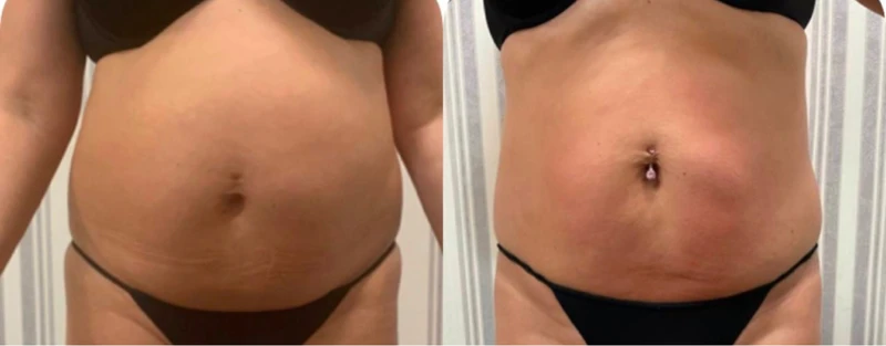 &