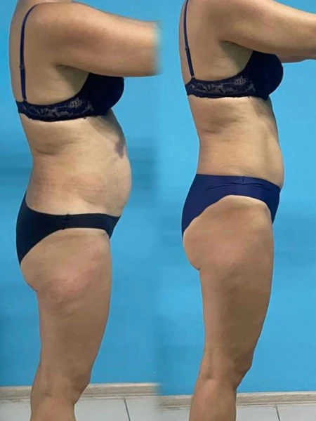 &