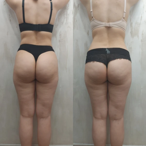 &
