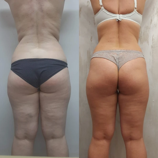 &