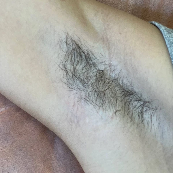 &