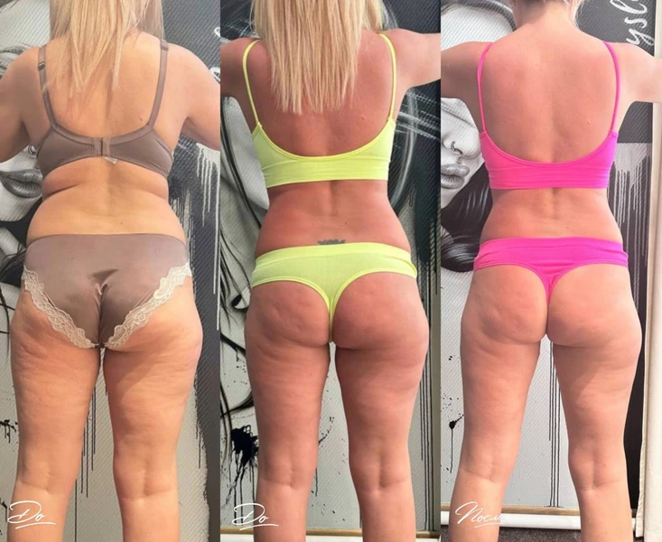 &