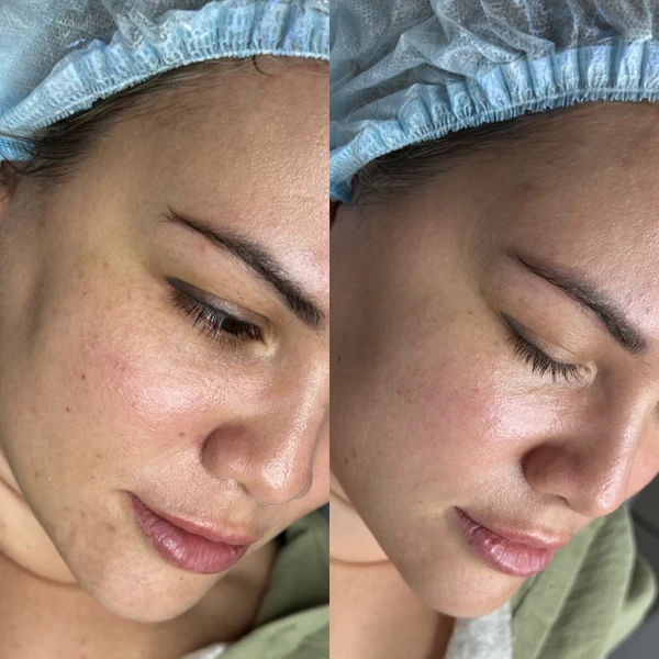 &