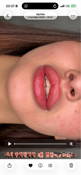 &
