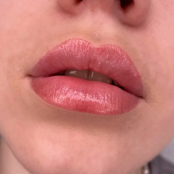 &