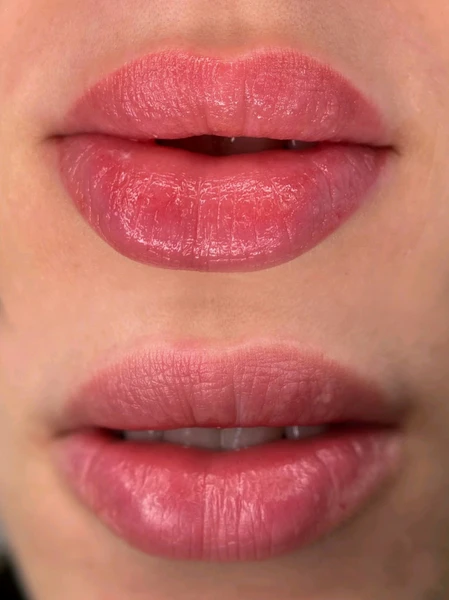 &
