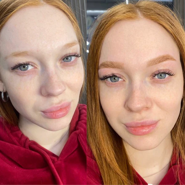 &