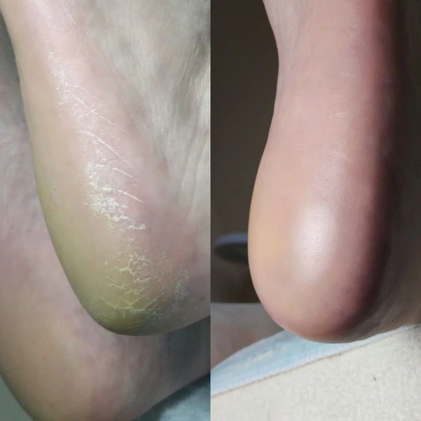 &