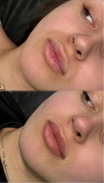 &