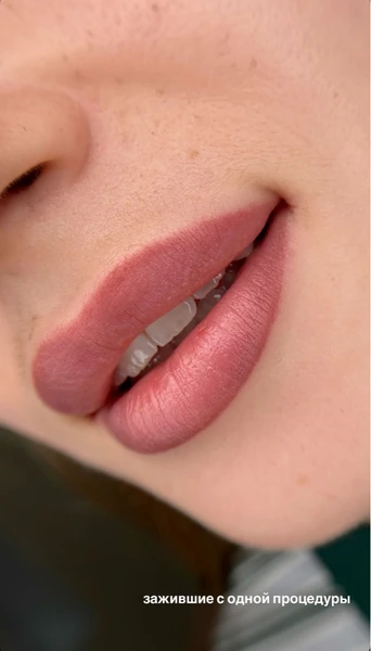 &