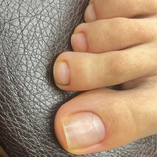 &