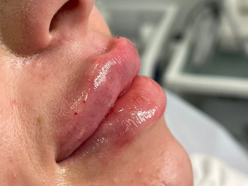 &