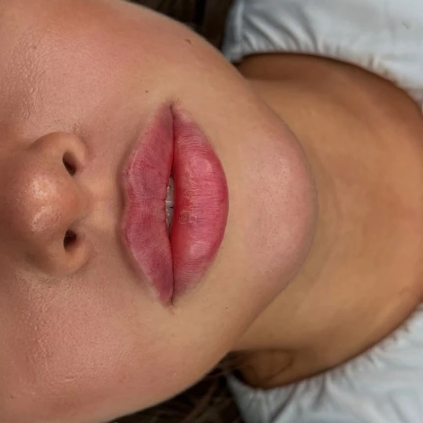 &