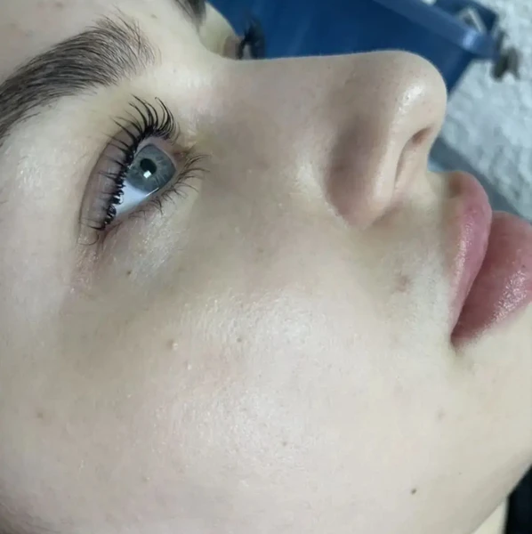 &
