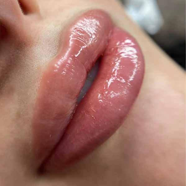 &