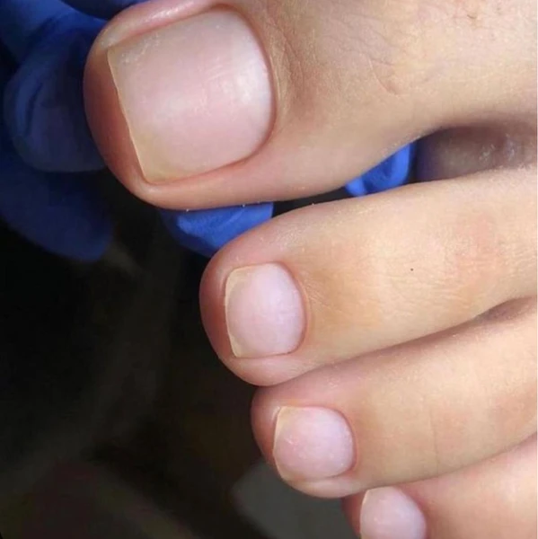 &