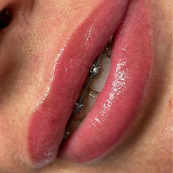 &