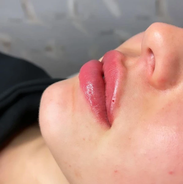 &