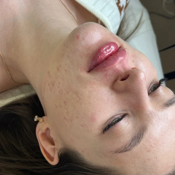 &