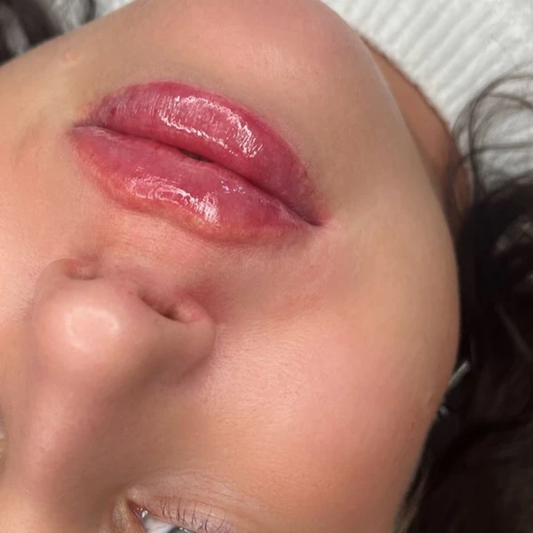&