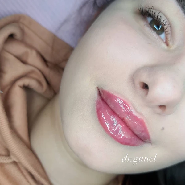 &