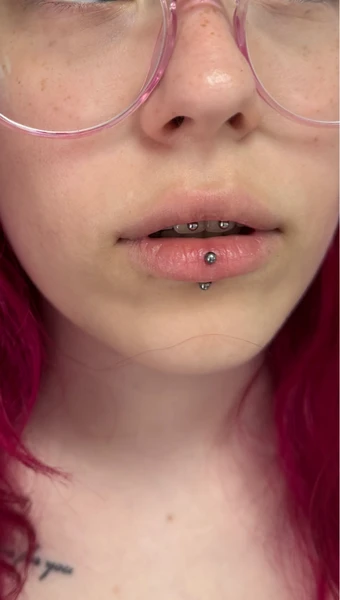 &