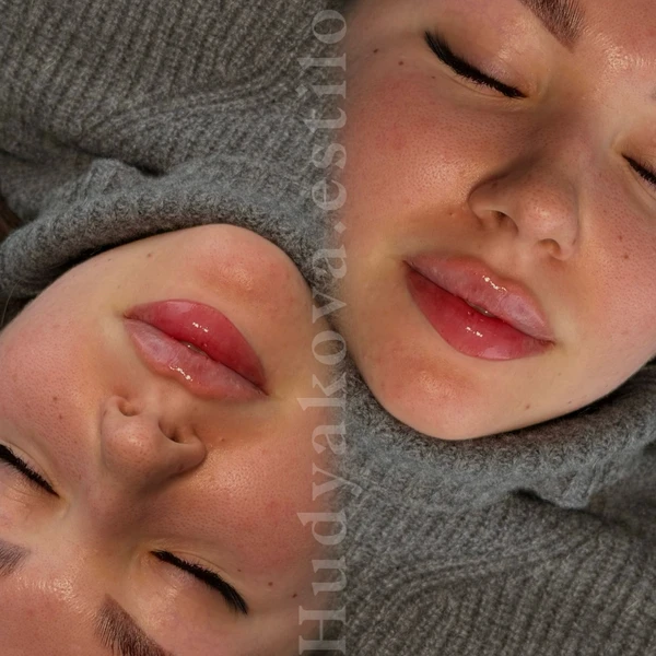 &
