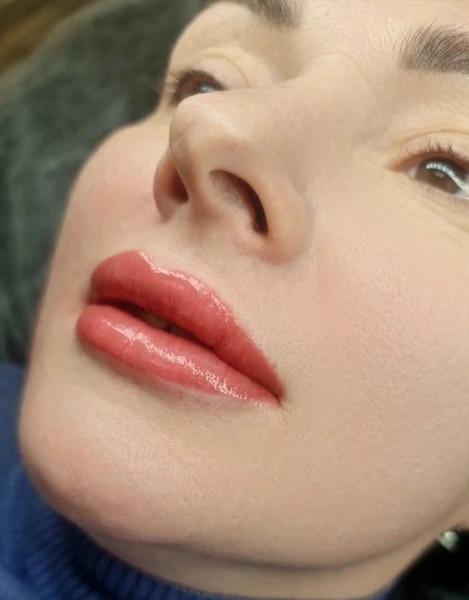 &