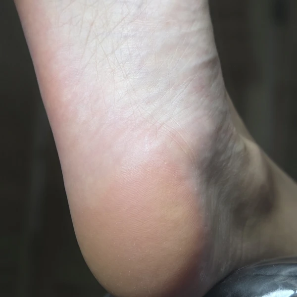 &