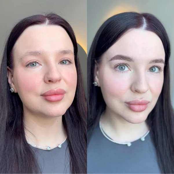 &