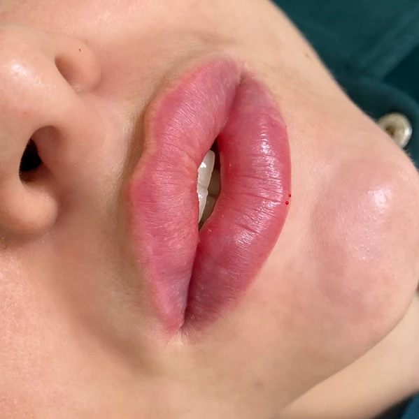&