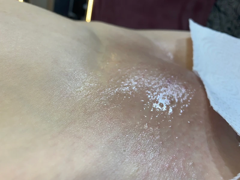 &