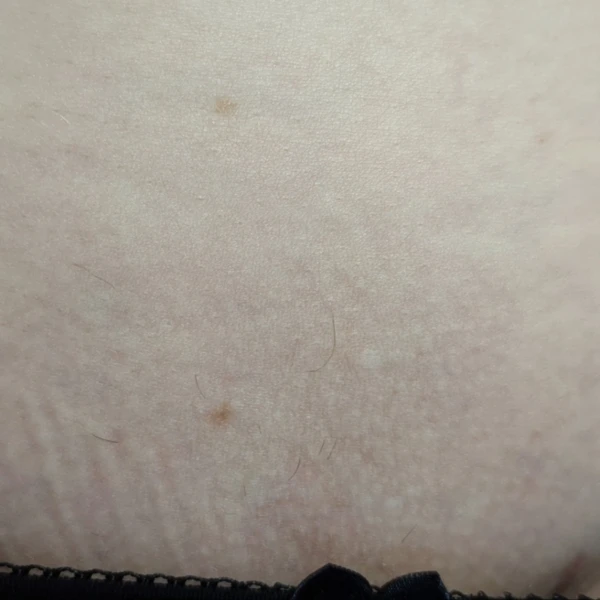 &
