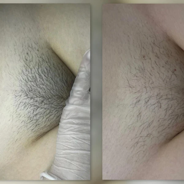 &