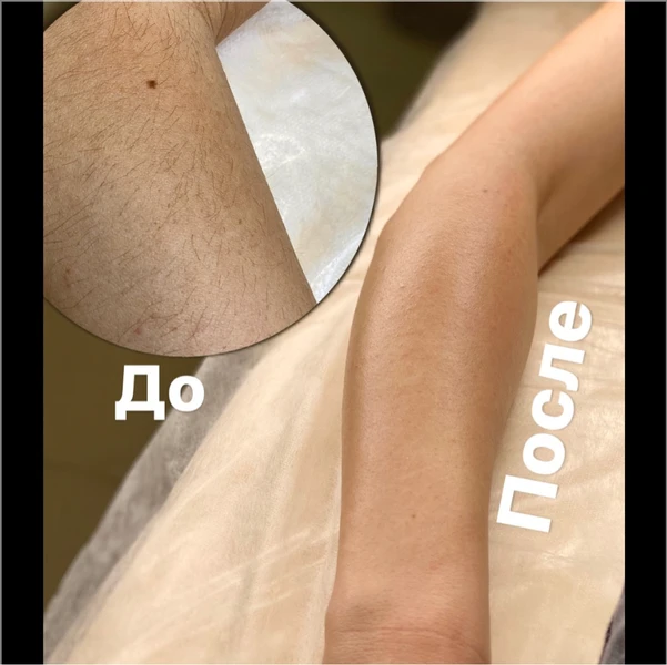 &
